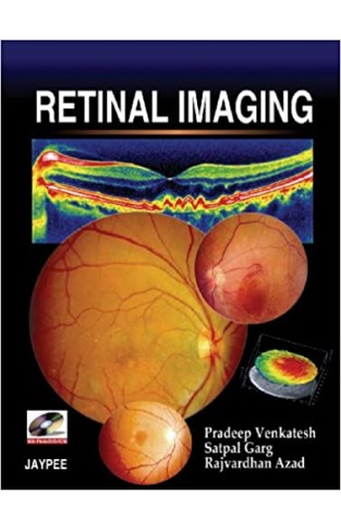 Retinal Imaging - (HB)